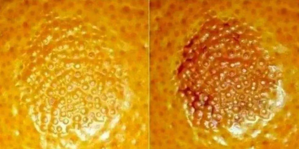 图片[1]-衰退病的柑橘树能治疗好吗-安远脐橙